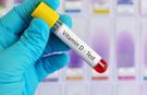Sağlık ocaklarında D vitamini testi yapılıyor mu?