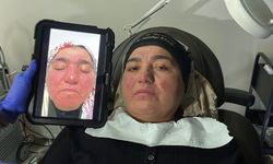 Yozgat’tan Sivas’a Uzanan Umut Yolculuğu