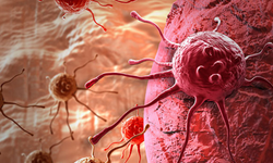 Hayat Kurtaran Uyarı: Kanserden Korunmak Mümkün