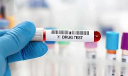 İş başvurularında uyuşturucu testi zorunlu mu?