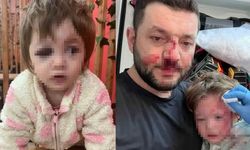 Komşu Dehşeti: 14 Aylık Bebek ve Babası Darp Edildi