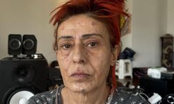 Yıldız Tilbe'nin sağlık durumu nasıl? Yıldız Tilbe kimdir, kaç yaşında ve nereli?