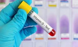 Sağlık ocaklarında D vitamini testi yapılıyor mu?