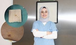 İl Dışına Gitmeye Gerek Kalmadı! Yozgat Şehir Hastanesi’nden Başarılı Operasyon