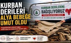 Yozgat'ta Kurban Derileri Alya Bebeğe Umut Oldu