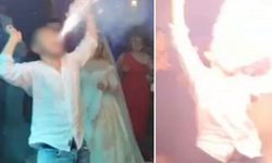 Düğünde Korku Dolu Anlar! Ağzındaki Meşale Bir Anda Patladı