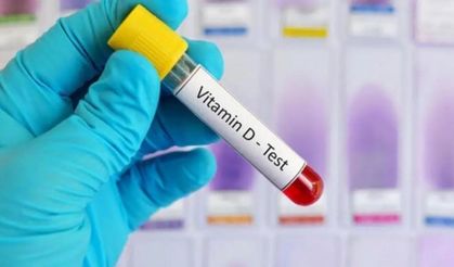 Sağlık ocaklarında D vitamini testi yapılıyor mu?