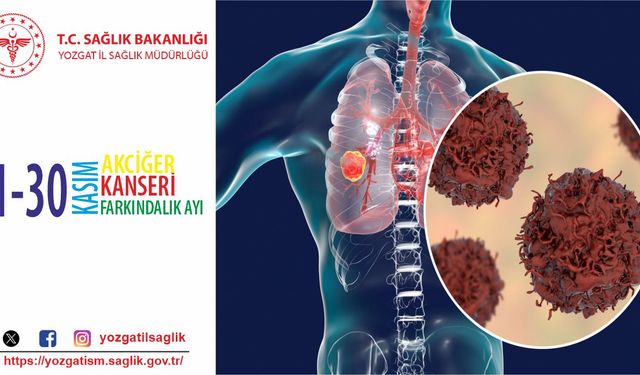 KANSERİN ANA NEDENİ SİGARA