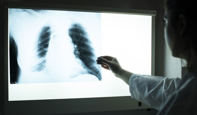 Uyarı Uzmandan Geldi! Uzamış Öksürük ve Kilo Kaybına Dikkat