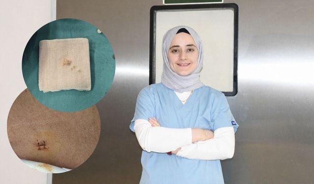 İl Dışına Gitmeye Gerek Kalmadı! Yozgat Şehir Hastanesi’nden Başarılı Operasyon
