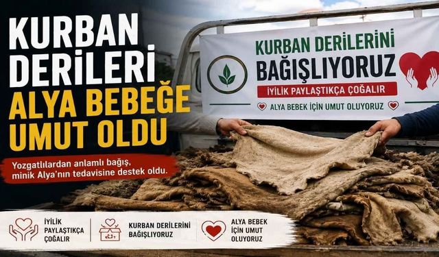 Yozgat'ta Kurban Derileri Alya Bebeğe Umut Oldu