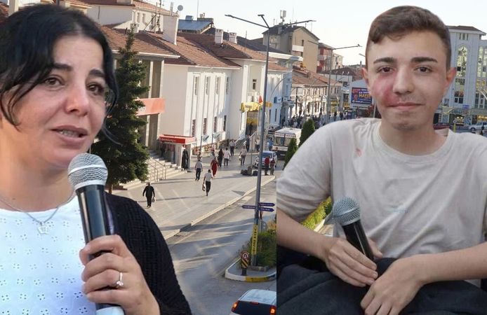 Yozgatlı DMD Hastası Furkan’ın Zamanla Yarışı "Son 5 Ayımız Kaldı, Sahip Çıkın"