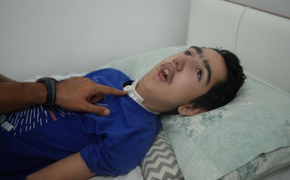 Bademcikameliyatısonrasıfelçkaldı (4)