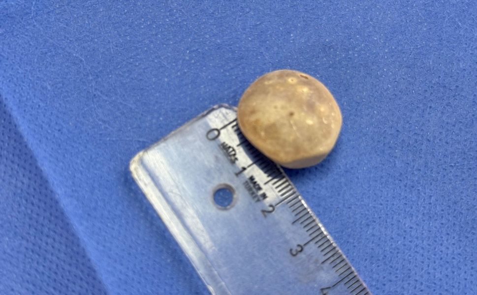 Yozgat Hakimiyet Gazetesi (24)-3