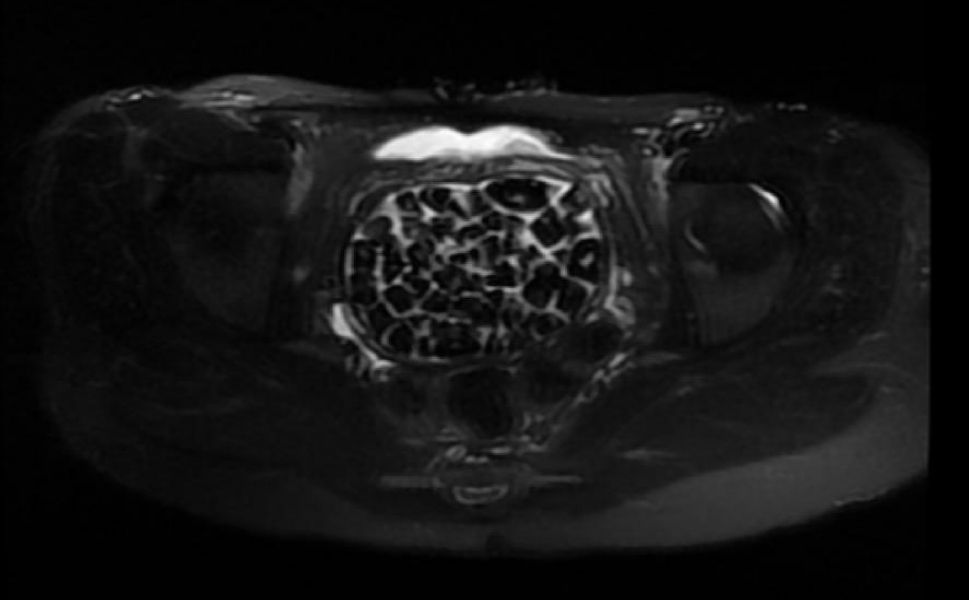 Yozgat Hakimiyet Gazetesi (25)-3