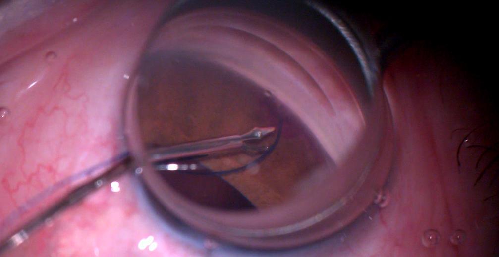 Yozgat’ta Ilk Kez Yapıldı Çevre Illere De Umut Oldu