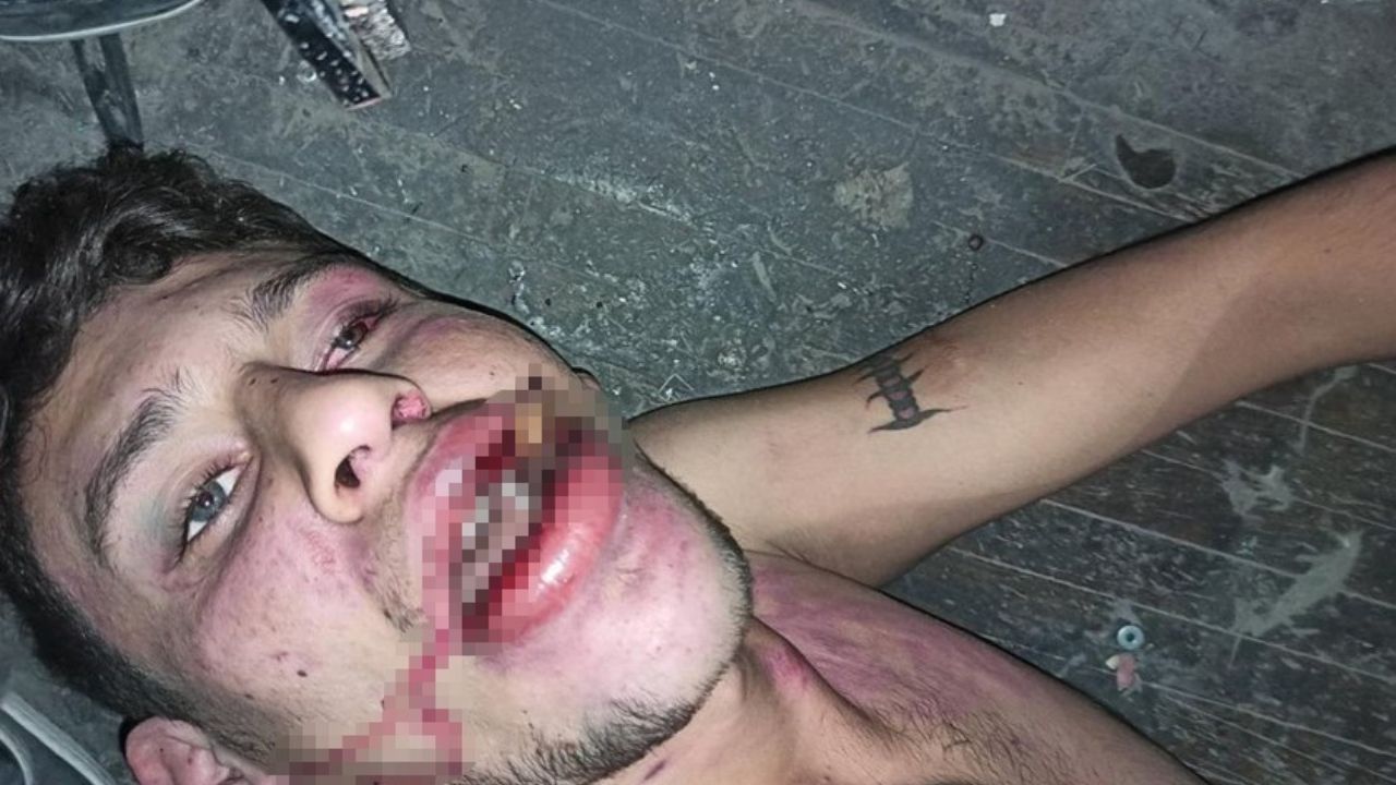 Korkunç İşkence 3 Gün Boyunca Darp Edildi Böcek Yedirildi!