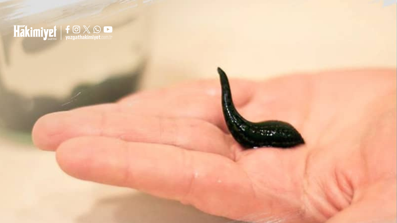 Yozgat’ta En Çok Talep Gören Yöntemler Masaya Yatırıldı Hacamat’tan Akupunktura (4)