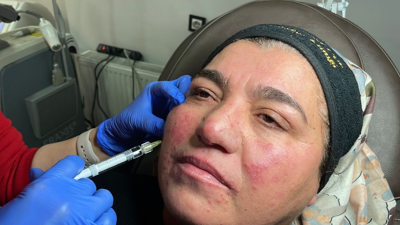 Gül Hastalağı (2)