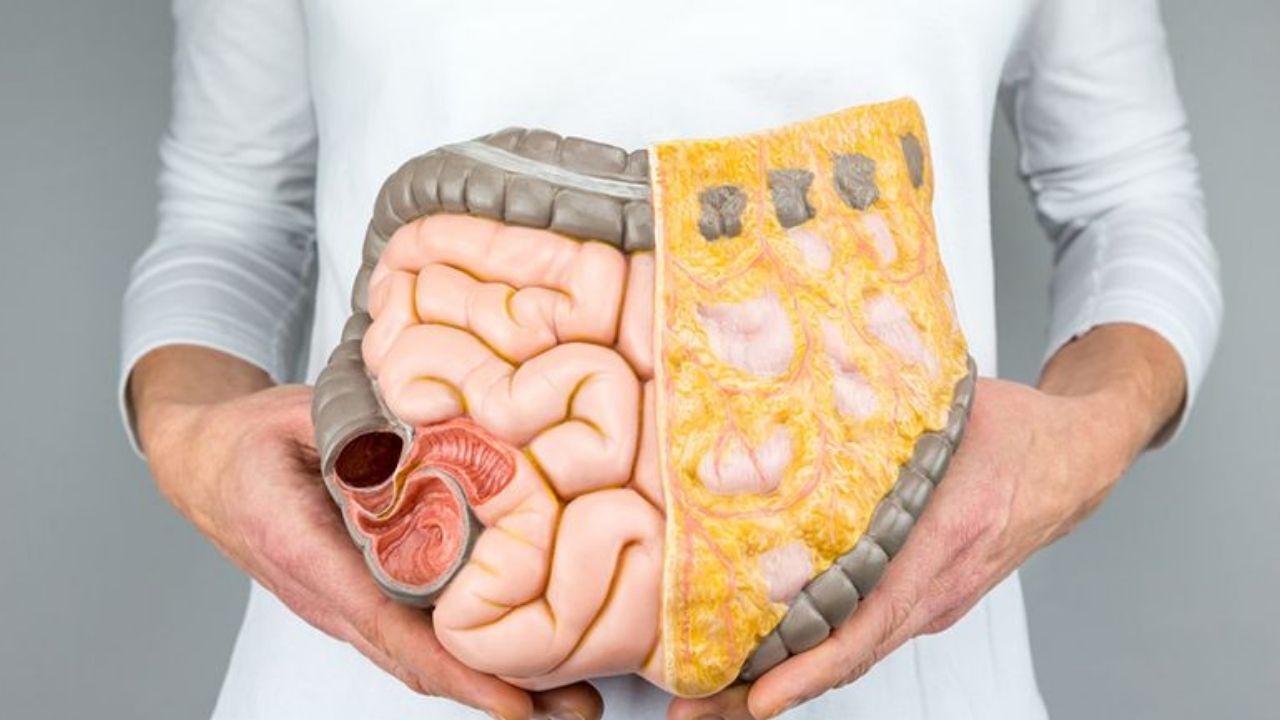 Yerköy’de Kolon Kanseri Farkındalığı Erken Teşhis Hayat Kurtarıyor (1)