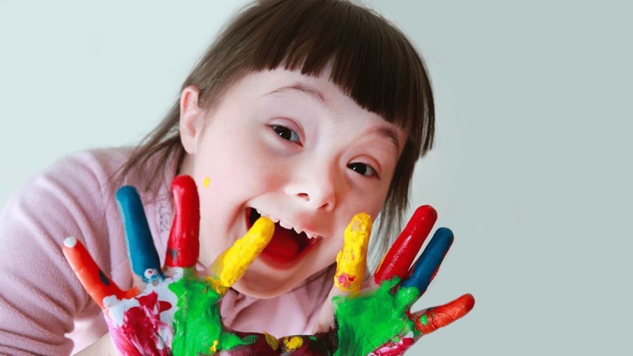 Yozgat’ta 21 Mart’ta Farkındalık Vurgusu ‘Down Sendromu Bir Hastalık Değil’ (2)