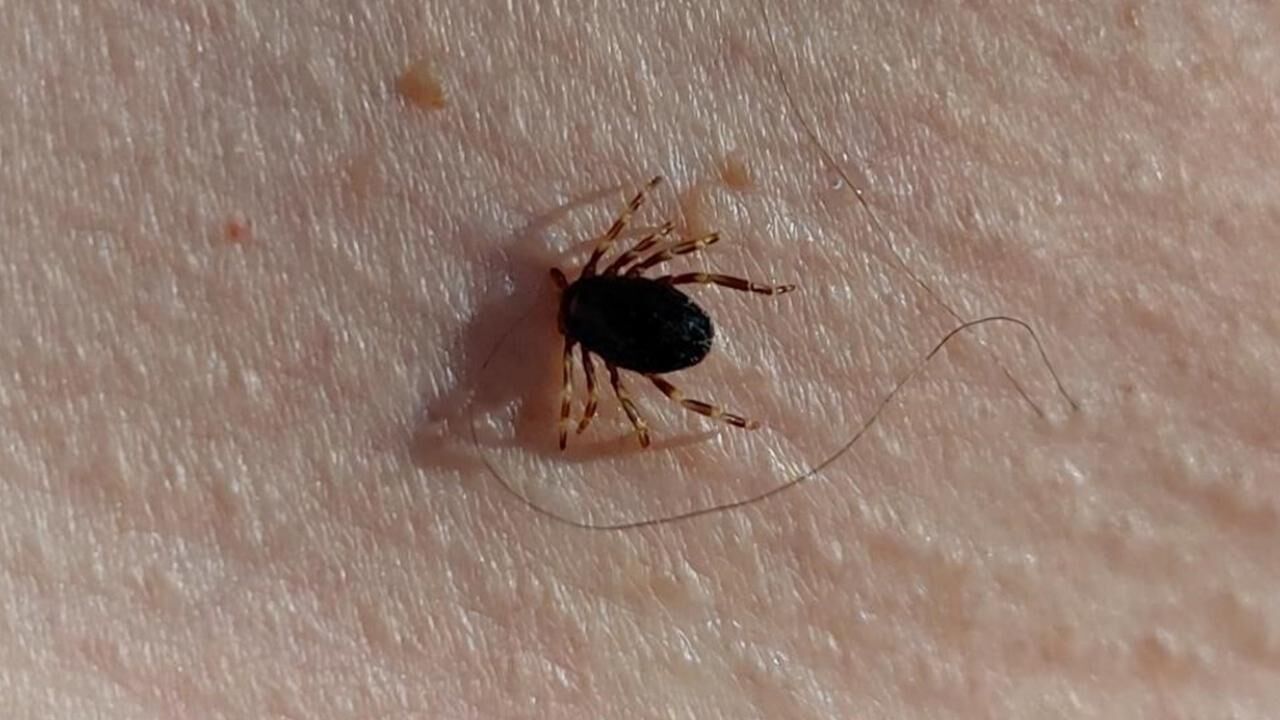 Kırım Kongo Kanamalı Ateşi'nde Tek Bulaş Kene Değil! (2)