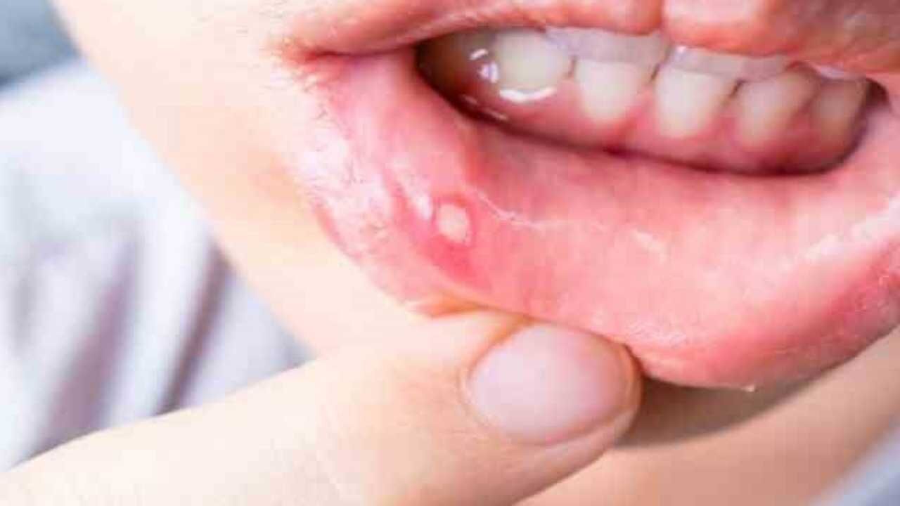 Toplumun Yüzde 25'Ini Etkiliyor Ama Sebebi Tam Bilinmiyor! Sakın Hafife Almayın (1)