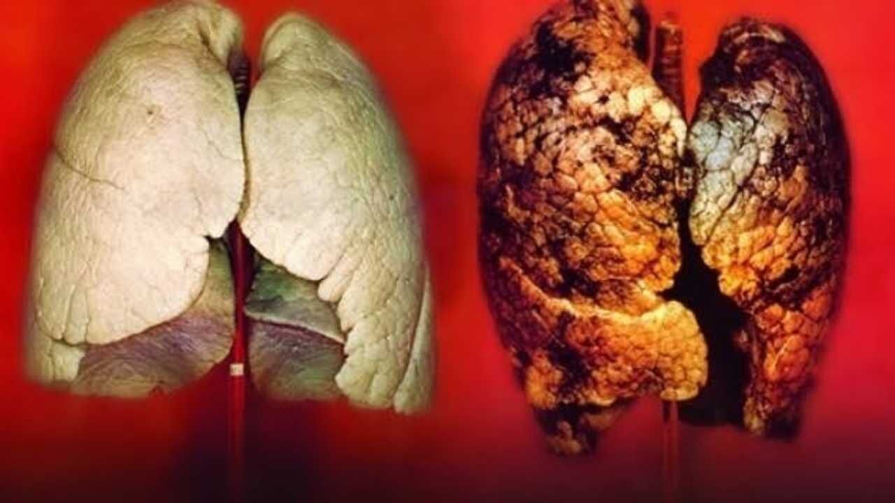 Yozgatlı Aileler Bu Tehlikeye Dikkat! Masum Sanılan O Ürünler Kanser Saçıyor (3)