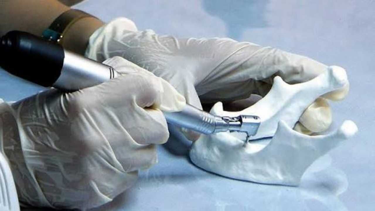 Yozgat'ta Diş Tedavisi Görenler Bu Hataya Düşüyor Tedaviyi Çöpe Attıran Nedeni Uzmanı Açıkladı! (2)