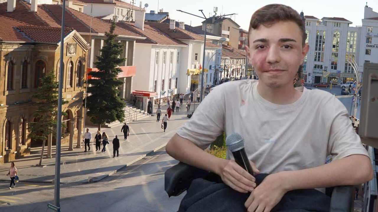 Yozgatlı Dmd Hastası Furkan’ın Zamanla Yarışı Son 5 Ayımız Kaldı, Sahip Çıkın (2)